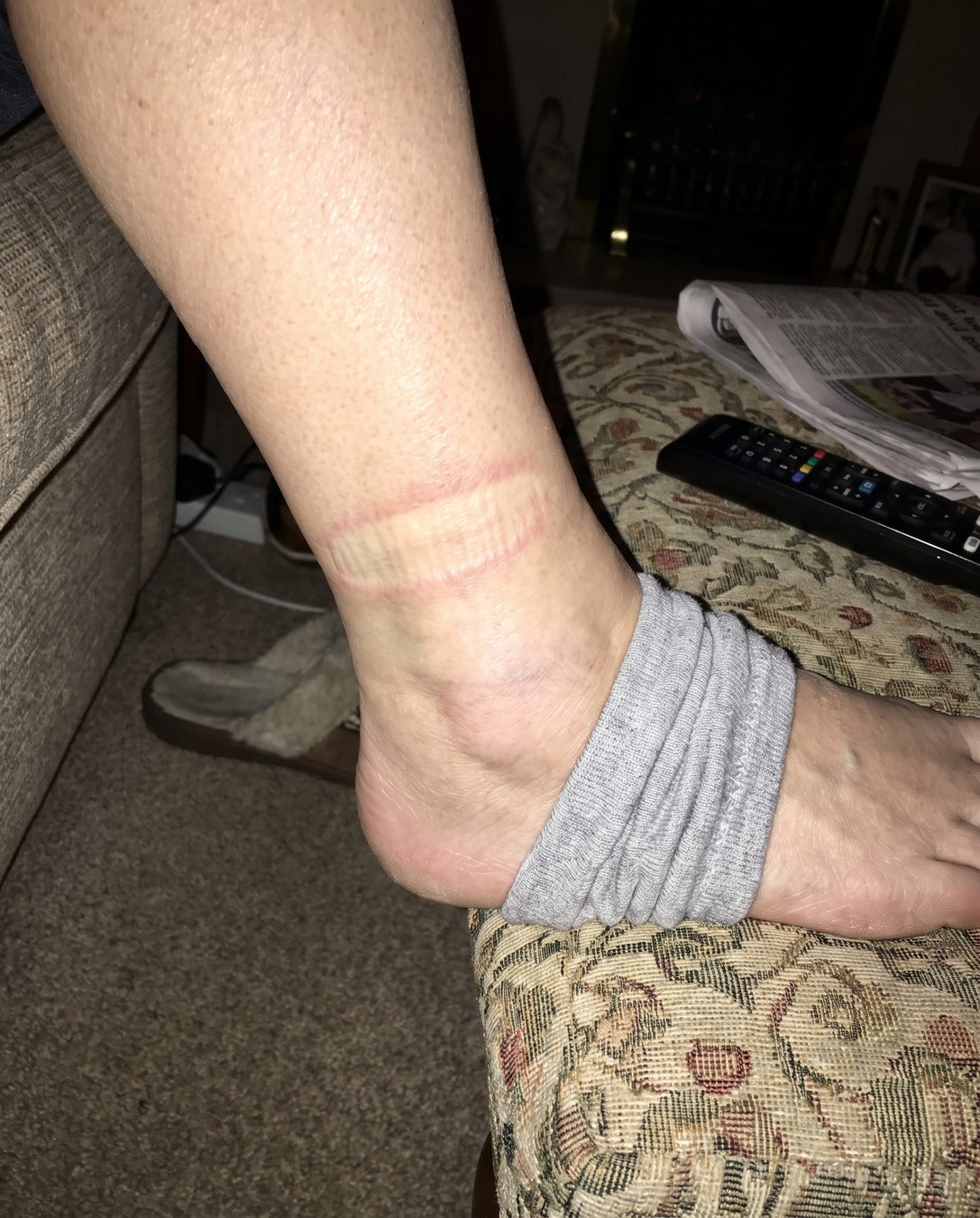 An older woman's lower leg in the evening, her grey sock pushed down to the heel and the band the elastic left all the way round